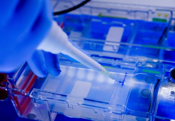 Plastic Injection Moulding Services